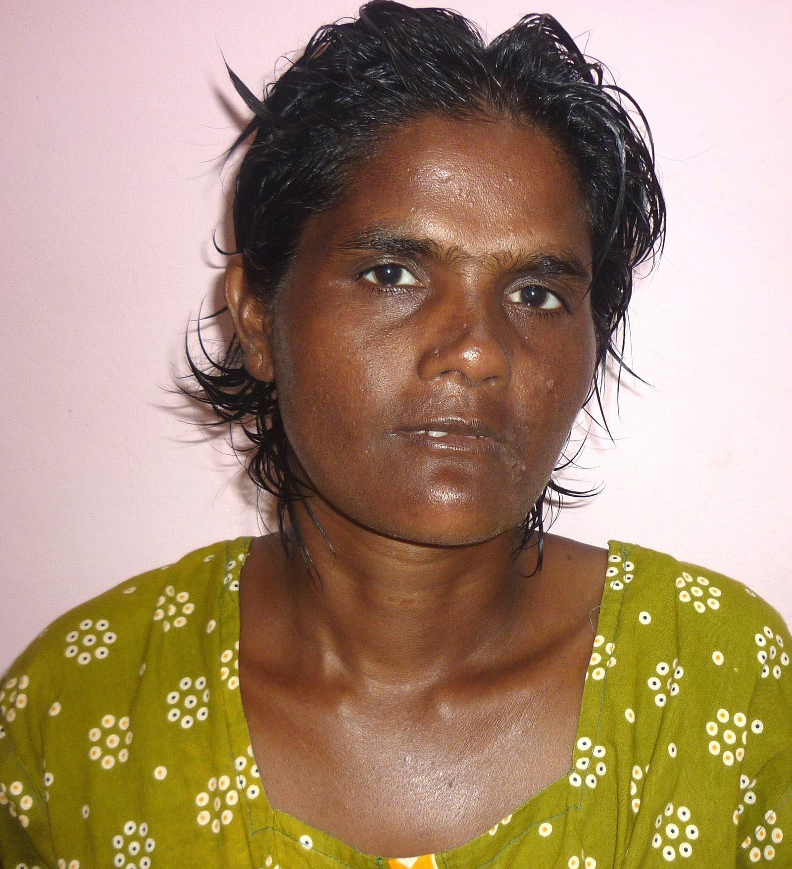 An inmate from vandanam Medical College